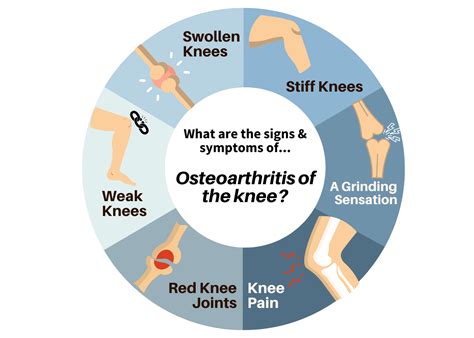 knee osteoarthritis stages  path  pain  life