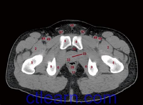 Anatomy Ct Axial Abdomen And Pelvis Male