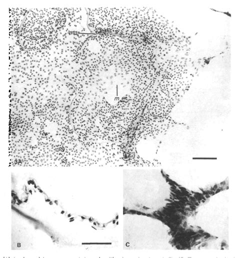 Figure 1 From Factors Modulating Mouse Lens Epithelial Cell Morphology With Differentiation And