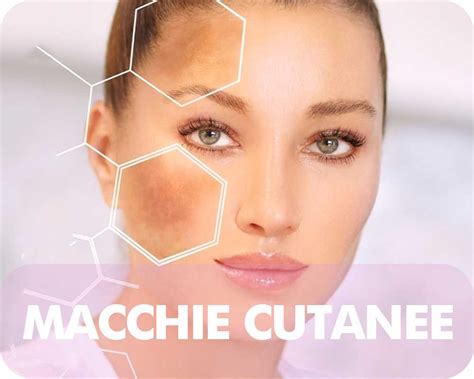 Trattamento E Rimozione Delle Macchie Cutanee Dermatologo Francesca