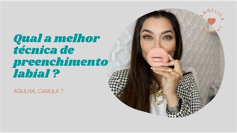 Qual Melhor Técnica De Preenchimento Labial Canula Ou Agulha Youtube