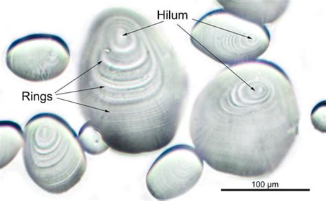 Food Microscopy- The Microscopic Structure of Starch Grains & Motic ...