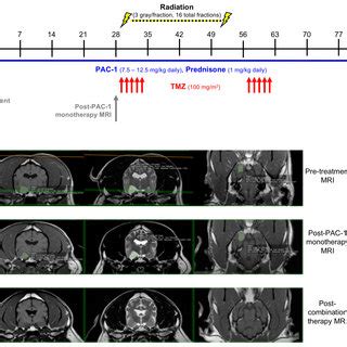 Evaluation Of Combining Oral PAC 1 With TMZ And Definitive Ionizing