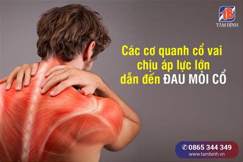 Đau mỏi cổ vai gáy Nguyên nhân triệu chứng và cách điều trị