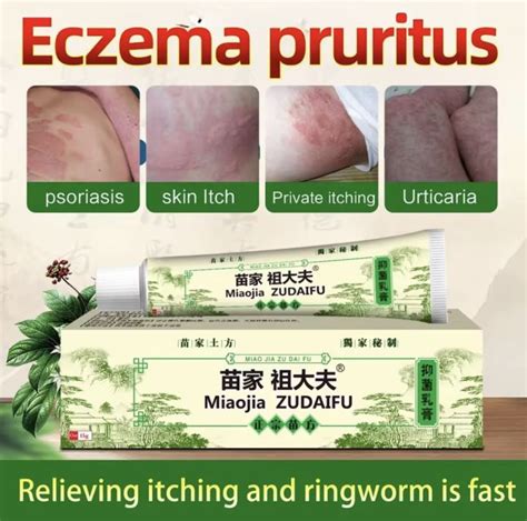 Authentic Zudaifu Cream Original Miracle Cream Ointment For Allergy