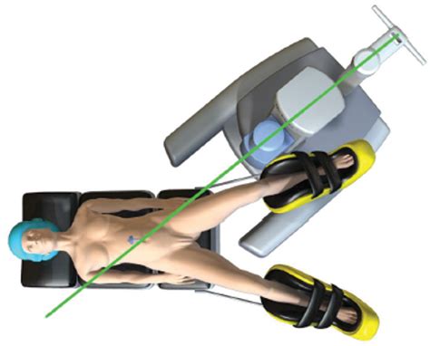 Figure 2 From Transanal Minimally Invasive Surgery For Total Mesorectal