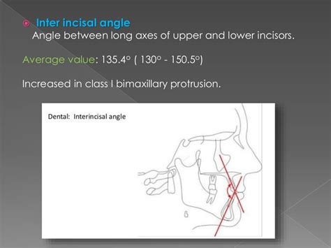 Cephalometrics In Orthodontics