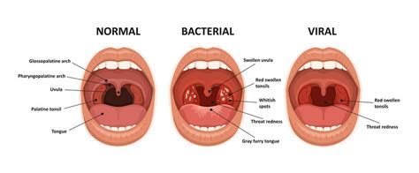 Uvula Anatomy