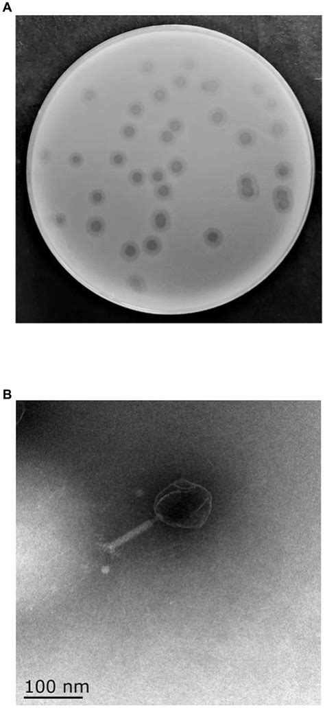 Frontiers Isolation And Characterization Of Novel Bacteriophage Vb