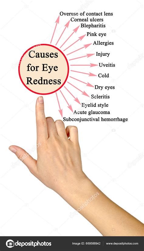 Causes Eye Redness — Stock Photo © vaeenma #669588942