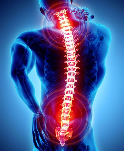 Back Spasms & Stem Cells: A different approach to relief - BioXcellerator