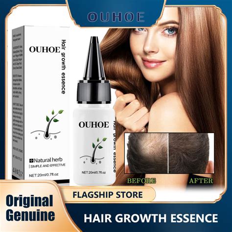 Ouhoe Hair Growth Essence Moisturizing Hair Streng Thening Hair Growth Care Hair Scalp Treatment