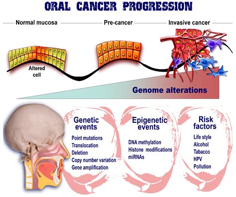 Ijms Free Full Text Current Insights Into Oral Cancer Epigenetics