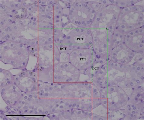 Distal Convoluted Tubule Slide