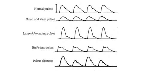 Different Types of Pulses | medcaretips.com