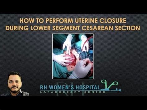 110 HOW TO PERFORM UTERINE CLOSURE DURING LOWER SEGMENT CESAREAN