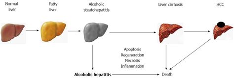 Liver Cirrhosis Alcohol