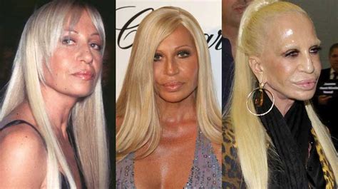 Donatella Versace Plastic Surgery Before and After Pictures 2018