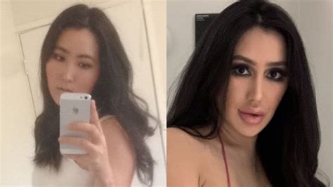 Woman Spends Whopping Rs 48 Lakh On Surgery To Look Like Kim Kardashian