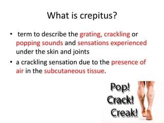 Crepitus | PPT