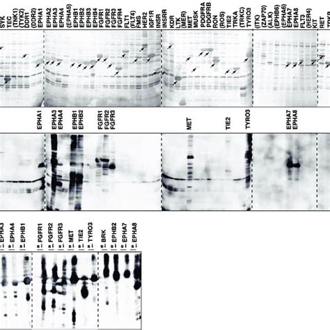 Expression Of Human Tyrosine Kinases In E Coli And Phosphorylation Of