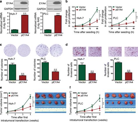 Eya4 Inhibits Hepatocellular Carcinoma Growth And Invasion By Suppressing Nf κb Dependent Rap1