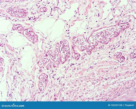 Histologia Do Tecido Adiposo Humano Foto De Stock Imagem De Laringe