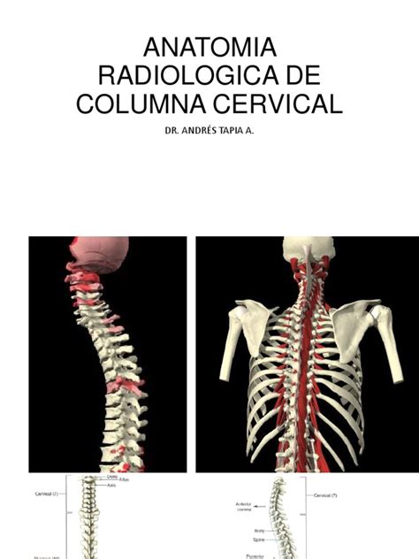 Pdf Anatomia Radiologica De Columna Cervical Dokumen Tips