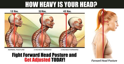 The Danger Of Forward Head Posture North Shore Chiro