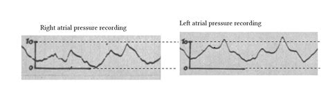 The Cardiac Cycle Deranged Physiology