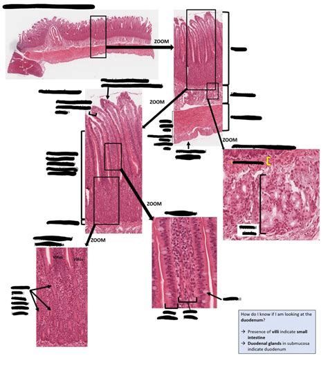 Duodenum Histology Diagram Quizlet