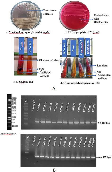 Identification Of Salmonella Typhi A Selective Plating Of Salmonella