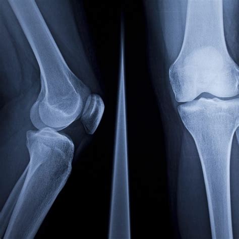 4 Best Habits For Stronger Bones At Every Age The Healthy Readers