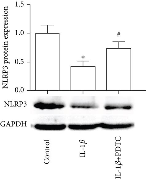 Lmx1b Depletion Suppressed Il 1β Induced Nf κb And Nlrp3 Activation