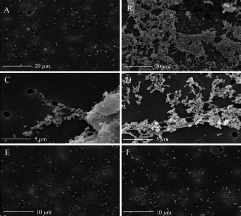 Scanning Electron Micrographs Of Suspension Cultures Of Brucella