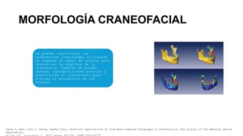 Tomografía computarizada de haz cónico CBCT pptx