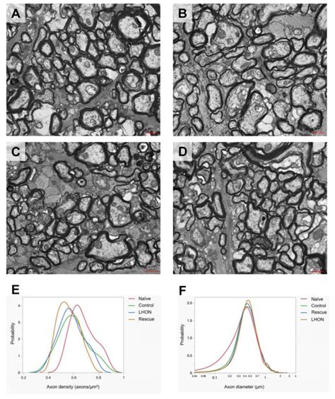 Wildtype Nd4 Protects Optic Nerve Degeneration A D Representative