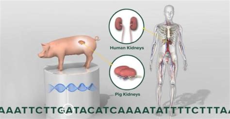 猪器官移植再传捷报全球首例猪肾脏成功移植入人体手机新浪网