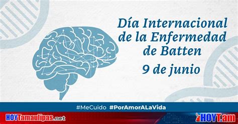 Hoy Tamaulipas Mexico Cuenta Con Tecnologia Para Detectar Demencia