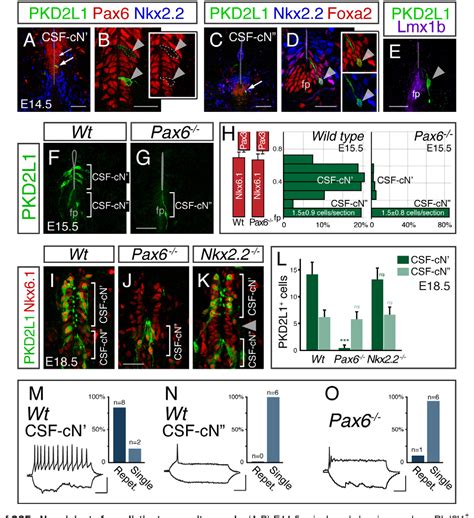 Figure From The Late And Dual Origin Of Cerebrospinal Fluid