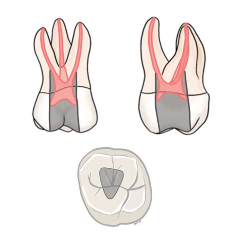 CDCA / ADEX - My Dental Key 