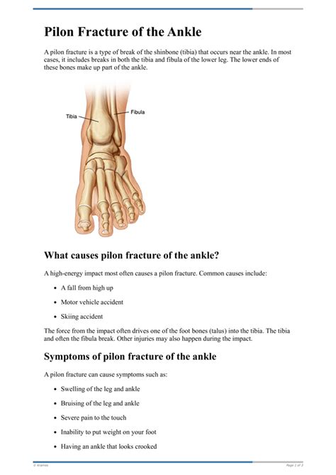 Text Pilon Fracture Of The Ankle Healthclips Online