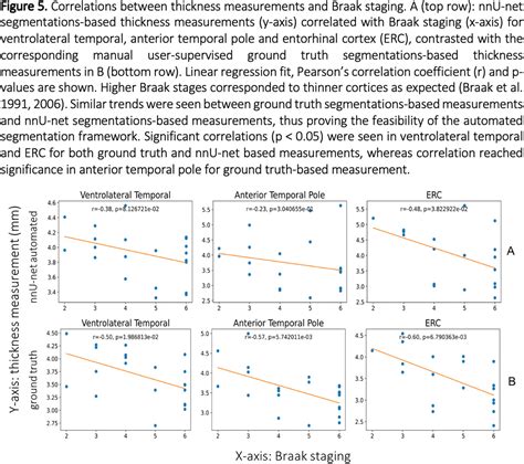 Deep Learning Pipeline For Cortical Gray Matter Segmentation And