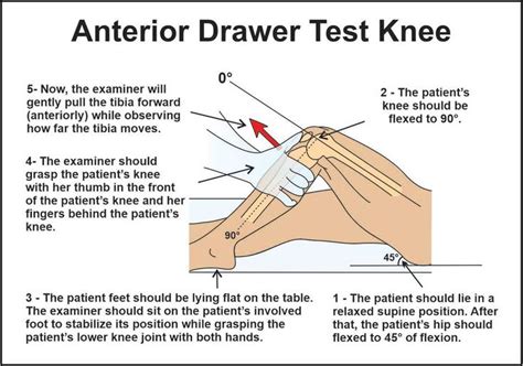 How To Detect Anterior Cruciate Ligament Tear Ligament Tear