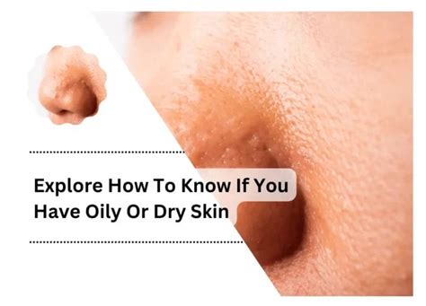 How To Fix Dry Skin Under Beard Best Guide Dryskin Wellness