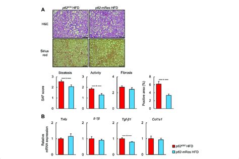 P62 Expression In Muscle Retards The Progression Of Nash A