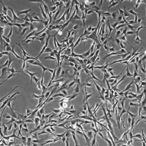 Primary Coronary Artery Smooth Muscle Cells