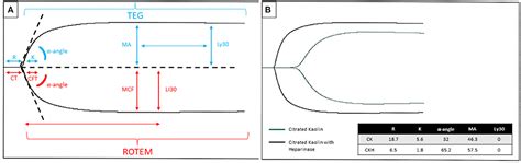 Frontiers Viscoelastic Testing In Pediatric Mechanical Circulatory