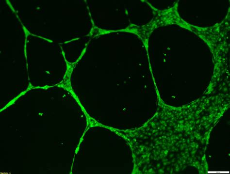 Cellvo Human Cord Blood Endothelial Progenitor Cells Are Highly