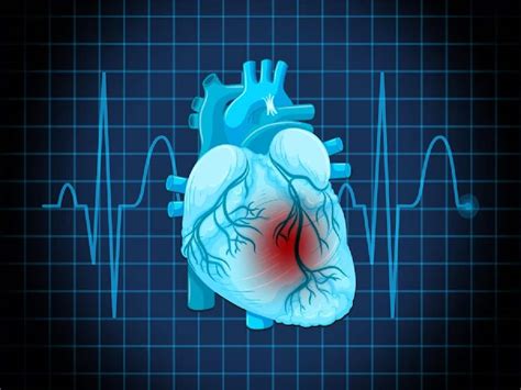 Heart Arrhythmia 8 Signs Of Heart Illness Induced By Irregular Heartbeats